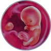 http://calcsoft.ru/img/pregnancy/10week.jpg